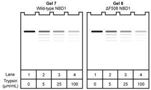 Passage The cystic fibrosis transmembrane conductance regulator (CFTR) protein is a chloride ion channel involved in the production of mucus, sweat, and digestive fluids. CFTR is composed of five domains (Figure 1) : Two transmembrane domains (TMD1 and TMD2) , two nucleotide binding domains (NBD1 and NBD2) , and one regulatory domain (R domain) . <strong>Figure 1</strong> Schematic diagram of CFTR domainsThe NBD domains regulate CFTR activity by binding ATP, which causes a conformational change in the TMD domains. This change allows chloride ions to leave cells by passively crossing the membrane down their concentration gradient. The R domain regulates activity further through dynamic phosphorylation at several positions. The movement of chloride ions facilitates the movement of water out of the cell by osmotic pressure and helps keep secretions thin.Cystic fibrosis (CF) arises from recessively inherited mutations in the CFTR gene. The most common mutation is a three-base-pair deletion that removes a phenylalanine residue at position 508 in NBD1 (ΔF508) . This mutation causes the protein to fold incorrectly, making it more susceptible to degradation by proteases. The resulting decrease in CFTR abundance inhibits chloride ion transport, leading to thickening of normally thin secretions and increased risk of life-threatening pulmonary infections. -If wild-type and ΔF508 NBD1 were isolated and incubated with increasing concentrations of the protease trypsin, which of the following SDS-PAGE gels would be consistent with the increased susceptibility of ΔF508 NBD1 to degradation? A) B) C) D)