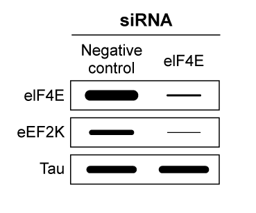<strong>Passage Alzheimer disease (AD) is a progressive condition affecting memory and cognition that can be pathologically characterized by the presence of neurofibrillary tangles (NFTs).  NFTs, aggregates of hyperphosphorylated tau proteins that have dissociated from microtubules, are believed to contribute to neuronal degradation and subsequent AD symptoms.  In general, ribosomes initiate translation of tau mRNA by binding the 7-methylguanosine (m7Gpp) cap present at the end of the 5′ untranslated region (UTR) of the mRNA molecule.  However, researchers believe that tau protein translation initiation can occur without recognition of the m7Gpp cap.  This alternate mechanism, referred to as cap-independent translation, indicates that ribosomes are recruited by internal ribosome entry sites (IRES) generally located in the 5′ UTR of the mRNA sequence.To determine the initiation mechanism of tau mRNA translation, neuroblastoma cells of AD mice were transfected with two different DNA constructs (Figure 1).  Construct 1 contained the 5′ UTR of tau mRNA isoforms (v1 and v2) extracted from cells displaying NFTs.  Construct 2 included the 5′ UTR of the β-globulin gene, which normally codes for a plasma protein.  The luciferase reporter genes, Renillla and Photinus, were also included in the two constructs. /_ /_   <strong>Figure 1</strong>  DNA constructs containing β-globulin or tau gene used to transfect neuroblastoma cellsLuciferase gene expression from the constructs was monitored in the absence and presence of a synthetic m7Gpp cap analog (Figure 2).  Translation of Renillla luciferase mRNA depended on ribosomal binding to the m7Gpp cap of the mRNA, but translation of Photinus luciferase required ribosome recruitment by an IRES in the 5′ UTR of the adjacent gene.   <strong>Figure 2</strong>  Luciferase activity in neuroblastoma cells exposed to m7Gpp cap analogIn a second study, researchers used siRNA to target initiation factor eIF4E, a peptide translated in a cap-dependent manner that facilitates the binding of ribosomes to the m7Gpp cap.  Expression of factor eIF4E, elongation factor eEF2K, and tau v2 protein was assessed in siRNA-treated cells (Figure 3).   <strong>Figure 3</strong>  Western blot of eIF4E, eEF2K, and tau v2 extracted from non-AD cells treated with eIF4E siRNA Adapted from Veo BL, Krushel LA. Translation initiation of the human tau mRNA through an internal ribosomal entry site. J Alzheimers Dis. 2009; 16(2):271-5. What conclusion can be made from the results shown in Figure 3?</strong> A)siRNA only binds the mRNA transcripts of proteins that facilitate IRES-ribosome binding. B)siRNA signals for the degradation of proteins that facilitate elongation of tau v2 proteins. C)eIF4e mRNA is translated via a cap-independent process. D)eEF2K mRNA is translated via a cap-dependent process. <div style=padding-top: 35px> 