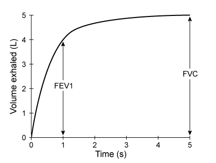 <strong>Passage Obstructive respiratory illnesses are characterized by an increased difficulty exhaling much of the air in the lungs.  Asthma and chronic obstructive pulmonary disease (COPD) are two of the most common obstructive respiratory illnesses.  Asthma is due to allergen hypersensitivity and can be identified by temporary airway inflammation, which causes the bronchioles to narrow.  The decreased airway diameter increases the resistance to airflow.  Subsequently, air becomes trapped in the lungs, restricting the amount of air that can be moved in each breath.COPD refers to a spectrum of disorders and can be a result of emphysema, the irreversible destruction of pulmonary tissue.  The breakdown of elastic proteins in the lungs results in a loss of pulmonary resiliency and chronic lung hyperinflation.  Because the walls between individual alveoli are broken down, the alveolar sacs that remain are larger.Lung diseases can be diagnosed and monitored using spirometry.  A spirometer measures the flow rate and volume of inhaled and exhaled air.  In one pulmonary test, a patient is asked to exhale forcibly and completely into a spirometer after maximum inhalation.  This test is done to measure the patient's forced expiratory volume in one second (FEV1) and forced vital capacity (FVC), the total amount of air exhaled in a single breath.   <strong>Figure 1</strong>  Forced expiratory spirogram of a healthy individual Adapted from T. Barreiro, An Approach to Interpreting Spirometry. American Family Physician. ©2004 AAFP. According to the passage, which of the following changes would be expected in a patient with signs of emphysema?</strong> A)Narrowing of the trachea B)Less efficient gas exchange C)Weakened diaphragm muscle D)Overstretched pharyngeal tissues <div style=padding-top: 35px> 