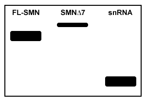 Passage Spinal muscular atrophy (SMA) is an autosomal recessive neuromuscular disease affecting 1 in 10,000 live births. The pathological hallmark of SMA is the loss of α-motor neurons in the spinal cord, which causes progressive paralysis and, ultimately, premature death in infants. SMA is caused by insufficient levels of survival motor neuron (SMN) , a regulatory protein required for the maintenance of the spinal cord nerve cells that control voluntary muscle movement.The SMN protein is generated from the SMN1 and SMN2 genes, which differ in sequence by only a single nucleotide in exon 7. In healthy individuals, the gene product of SMN1 is the full-length (FL) SMN protein, and the gene products of SMN2 are both the FL-SMN protein as well as a truncated unstable protein (SMNΔ7) that is rapidly degraded. Approximately 90% of the SMN2 gene product is SMNΔ7, and only 10% is FL-SMN (Figure 1) . In most patients with SMA, SMN1 is mutated such that its protein product is nonfunctional or deleted. The disease phenotype arises because the SMN2 gene cannot fully compensate for the deficiency in FL-SMN protein synthesis. <strong>Figure 1</strong> Structure of SMN1 and SMN2 transcriptsAntisense oligonucleotides (ASOs) that bind pre-mRNA were injected into SMA mice (SMN1<sup>−/−</sup>, SMN2<sup>+/+</sup>) exhibiting progressive tail necrosis, a characteristic measure of SMA severity. ASO therapy effectiveness was assessed by measuring the tail length of wild-type (WT) mice and SMA mice exposed to increasing concentrations of ASOs (Figure 2) . <strong>Figure 2</strong> Tail length progression of WT mice compared to SMA mice treated with either saline or ASOs Adapted from Lorson CL, Hahnen E, Androphy EJ, Wirth B. A single nucleotide in the SMN gene regulates splicing and is responsible for spinal muscular atrophy. Proc Natl Acad Sci USA. 1999;96(11) :6307-11. -Researchers have discovered that SMN plays a role in its own mRNA processing, and that FL-SMN enhances the expression of small nuclear RNAs (snRNA) required to produce mature FL-SMN mRNA. In motor neurons of SMA patients, the feedback mechanism between SMN protein and SMN mature mRNA is shown in which northern blot sample? A) B) C) D)