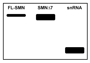 Passage Spinal muscular atrophy (SMA) is an autosomal recessive neuromuscular disease affecting 1 in 10,000 live births. The pathological hallmark of SMA is the loss of α-motor neurons in the spinal cord, which causes progressive paralysis and, ultimately, premature death in infants. SMA is caused by insufficient levels of survival motor neuron (SMN) , a regulatory protein required for the maintenance of the spinal cord nerve cells that control voluntary muscle movement.The SMN protein is generated from the SMN1 and SMN2 genes, which differ in sequence by only a single nucleotide in exon 7. In healthy individuals, the gene product of SMN1 is the full-length (FL) SMN protein, and the gene products of SMN2 are both the FL-SMN protein as well as a truncated unstable protein (SMNΔ7) that is rapidly degraded. Approximately 90% of the SMN2 gene product is SMNΔ7, and only 10% is FL-SMN (Figure 1) . In most patients with SMA, SMN1 is mutated such that its protein product is nonfunctional or deleted. The disease phenotype arises because the SMN2 gene cannot fully compensate for the deficiency in FL-SMN protein synthesis. <strong>Figure 1</strong> Structure of SMN1 and SMN2 transcriptsAntisense oligonucleotides (ASOs) that bind pre-mRNA were injected into SMA mice (SMN1<sup>−/−</sup>, SMN2<sup>+/+</sup>) exhibiting progressive tail necrosis, a characteristic measure of SMA severity. ASO therapy effectiveness was assessed by measuring the tail length of wild-type (WT) mice and SMA mice exposed to increasing concentrations of ASOs (Figure 2) . <strong>Figure 2</strong> Tail length progression of WT mice compared to SMA mice treated with either saline or ASOs Adapted from Lorson CL, Hahnen E, Androphy EJ, Wirth B. A single nucleotide in the SMN gene regulates splicing and is responsible for spinal muscular atrophy. Proc Natl Acad Sci USA. 1999;96(11) :6307-11. -Researchers have discovered that SMN plays a role in its own mRNA processing, and that FL-SMN enhances the expression of small nuclear RNAs (snRNA) required to produce mature FL-SMN mRNA. In motor neurons of SMA patients, the feedback mechanism between SMN protein and SMN mature mRNA is shown in which northern blot sample? A) B) C) D)