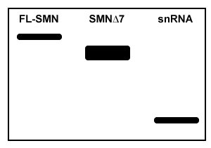 Passage Spinal muscular atrophy (SMA) is an autosomal recessive neuromuscular disease affecting 1 in 10,000 live births. The pathological hallmark of SMA is the loss of α-motor neurons in the spinal cord, which causes progressive paralysis and, ultimately, premature death in infants. SMA is caused by insufficient levels of survival motor neuron (SMN) , a regulatory protein required for the maintenance of the spinal cord nerve cells that control voluntary muscle movement.The SMN protein is generated from the SMN1 and SMN2 genes, which differ in sequence by only a single nucleotide in exon 7. In healthy individuals, the gene product of SMN1 is the full-length (FL) SMN protein, and the gene products of SMN2 are both the FL-SMN protein as well as a truncated unstable protein (SMNΔ7) that is rapidly degraded. Approximately 90% of the SMN2 gene product is SMNΔ7, and only 10% is FL-SMN (Figure 1) . In most patients with SMA, SMN1 is mutated such that its protein product is nonfunctional or deleted. The disease phenotype arises because the SMN2 gene cannot fully compensate for the deficiency in FL-SMN protein synthesis. <strong>Figure 1</strong> Structure of SMN1 and SMN2 transcriptsAntisense oligonucleotides (ASOs) that bind pre-mRNA were injected into SMA mice (SMN1<sup>−/−</sup>, SMN2<sup>+/+</sup>) exhibiting progressive tail necrosis, a characteristic measure of SMA severity. ASO therapy effectiveness was assessed by measuring the tail length of wild-type (WT) mice and SMA mice exposed to increasing concentrations of ASOs (Figure 2) . <strong>Figure 2</strong> Tail length progression of WT mice compared to SMA mice treated with either saline or ASOs Adapted from Lorson CL, Hahnen E, Androphy EJ, Wirth B. A single nucleotide in the SMN gene regulates splicing and is responsible for spinal muscular atrophy. Proc Natl Acad Sci USA. 1999;96(11) :6307-11. -Researchers have discovered that SMN plays a role in its own mRNA processing, and that FL-SMN enhances the expression of small nuclear RNAs (snRNA) required to produce mature FL-SMN mRNA. In motor neurons of SMA patients, the feedback mechanism between SMN protein and SMN mature mRNA is shown in which northern blot sample? A) B) C) D)