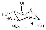 Passage The radiopharmaceutical 2-deoxy-2-(<sup>18</sup>F) fluoro-D-glucose (abbreviated as <sup>18</sup>F-FDG) is a modified form of D-glucose in which the hydroxyl group on the 2-carbon of the molecule has been replaced with a positron-emitting <sup>18</sup>F radionuclide. Synthesis of <sup>18</sup>F-FDG is accomplished in several steps involving both nuclear and chemical reactions, as shown in Figure 1. <strong>Figure 1</strong> Synthetic scheme for 2-deoxy-2-(<sup>18</sup>F) fluoro-D-glucoseInitially, a target of <sup>18</sup>O-enriched water (<sup>18</sup>OH<sub>2</sub>) is bombarded by protons using a cyclotron to achieve a (p-n) nuclear reaction in which a proton hitting the <sup>18</sup>O nucleus is absorbed by the nucleus, causing the ejection of a neutron and forming an <sup>18</sup>F nucleus. Following separation of the resulting <sup>18</sup>F<sup>−</sup> anions from the residual <sup>18</sup>OH<sub>2</sub> via an ion exchange column, <sup>18</sup>F<sup>−</sup> is used in a nucleophilic substitution reaction with an acetylated mannose triflate substrate. Subsequent hydrolysis to remove the acetyl protecting groups yields <sup>18</sup>F-FDG.Because <sup>18</sup>F-FDG is an analog of D-glucose, it is readily taken into cells by the same metabolic processes as D-glucose. Once inside the cells, the positron emissions of the <sup>18</sup>F radionuclide can be detected by positron emission tomography (PET) scans to produce diagnostic medical images of objects such as tumors. Emissions from the <sup>18</sup>F radionuclide subsequently diminish over time via radioactive decay (Figure 2) . <strong>Figure 2</strong> Nuclear decay of the <sup>18</sup>F radionuclideBecause of limitations in the spatial resolution of PET scanners, when an object (such as a tumor) is smaller than 30 mm in diameter, the measured specific uptake value (SUV) of <sup>18</sup>F-FDG accumulated within the object is lower than the actual SUV. The recovery coefficient (the ratio of the measured SUV to the actual SUV) shows that the measured SUV decreases as the size of the object decreases below the 30-mm threshold (Figure 3) . <strong>Figure 3</strong> Recovery coefficient as a function of object size in a PET scan with a spatial resolution of 7 mm using ordered subsets expectation maximization (OSEM) image processing Adapted from: S. Yu. Review of F-FDG Synthesis and Quality Control. Biomed Imaging Interv J. ©2006 Department of Biomedical Imaging, Faculty of Medicine, University of Malaysa; and P. E. Kinahan, et al., Positron emission tomography-computed tomography standardized uptake values in clinical practice and assessing response to therapy. Semin Ultrasound CT MR. ©2010 Elsevier. -Which of the following products is formed from <sup>18</sup>F-FDG following a positron emission? (Note: Assume any anions produced acquire hydrogen ions from the aqueous physiological environment.) A) B) C) D)