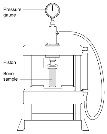 Passage Osteoporosis is a degenerative bone condition in which healthy bone degenerates into porous bone.  Because bone provides the structural integrity that allows the musculoskeletal system to bear weight, osteoporosis is associated with a higher risk of bone fracture.Researchers conducted an experiment designed to assess the strength and elasticity of osteoporotic bone relative to normal bone.  Osteoporotic and normal bone samples with identical physical dimensions were collected and placed within an pneumatic compression device, as shown in Figure 1.    <strong>Figure 1</strong>  Bone compression device loaded with a bone sampleThe force required to compress the bone samples longitudinally (lengthwise)  by a given distance was measured, with the results shown in Figure 2.    <strong>Figure 2</strong>  Relationship between force and compression for normal and osteoporotic bonesResearchers observed that bone samples returned to their original dimensions for deformations not exceeding 1% of the original length L<sub>0</sub>.  For each deformation, the associated strain ε is defined as the change in length of an object ΔL divided by the object's original length (Equation 1) .    <strong>Equation 1</strong>Based on these observations<strong>,</strong> researchers concluded that both osteoporotic bone and normal bone behaved as an elastic material under a wide range of applied forces. -According to the data in Figure 2, what is the spring constant k for normal bone? A) 7.5 kN/mm B) 10 kN/mm C) 30 kN/mm D) 40 kN/mm