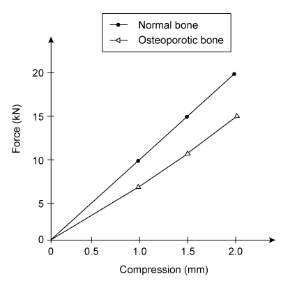Passage Osteoporosis is a degenerative bone condition in which healthy bone degenerates into porous bone.  Because bone provides the structural integrity that allows the musculoskeletal system to bear weight, osteoporosis is associated with a higher risk of bone fracture.Researchers conducted an experiment designed to assess the strength and elasticity of osteoporotic bone relative to normal bone.  Osteoporotic and normal bone samples with identical physical dimensions were collected and placed within an pneumatic compression device, as shown in Figure 1.    <strong>Figure 1</strong>  Bone compression device loaded with a bone sampleThe force required to compress the bone samples longitudinally (lengthwise)  by a given distance was measured, with the results shown in Figure 2.    <strong>Figure 2</strong>  Relationship between force and compression for normal and osteoporotic bonesResearchers observed that bone samples returned to their original dimensions for deformations not exceeding 1% of the original length L<sub>0</sub>.  For each deformation, the associated strain ε is defined as the change in length of an object ΔL divided by the object's original length (Equation 1) .    <strong>Equation 1</strong>Based on these observations<strong>,</strong> researchers concluded that both osteoporotic bone and normal bone behaved as an elastic material under a wide range of applied forces. -According to the data in Figure 2, what is the spring constant k for normal bone? A) 7.5 kN/mm B) 10 kN/mm C) 30 kN/mm D) 40 kN/mm