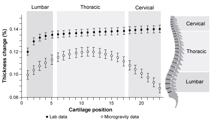 Passage The effects of gravity are effectively negated if an object is in free fall.  For example, an object orbiting the Earth experiences an apparent weightlessness known as microgravity.  Because the human body evolved under the influence of Earth's gravity, human physiology undergoes several changes in microgravity environments.  Puffy face syndrome (PFS)  occurs when an astronaut's extracellular fluid shifts toward upper body regions, resulting in facial bulging and leg shrinkage.  Elongation of the spinal column also occurs as intervertebral discs (spinal cartilage)  decompress, making astronauts up to 6 cm taller.Researchers simulated microgravity-induced spinal elongation on Earth by suspending 50 volunteers by the arms, holding each above the ground in an upright position.  The thickness of each intervertebral disc was measured prior to and following 10 minutes of suspension.  Researchers then compared the percentage change in intervertebral disc thickness to similar measurements recorded in microgravity, as shown in Figure 1.    <strong>Figure 1</strong>  Percentage change in intervertebral disc thicknessIn theory, spinal elongation would also occur in reduced-gravity environments like the surface of the Moon, where the acceleration of gravity is one-sixth that observed on the Earth's surface. -A volunteer with a mass of 80 kg is suspended by his arms on Earth.  What is the approximate tension on lumbar disc 1?  (Note: The acceleration of gravity is g = 10 m/s<sup>2</sup>)  A) 40 N B) 70 N C) 400 N D) 700 N
