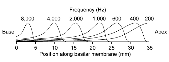 Passage Sound waves propagate through many conducting structures in the ear before they are transduced into neuronal signals.  When sound waves reach the fluid-filled cochlea, they are detected by hair cells lining the basilar membrane.  The cochlear spiral can be modeled as a resonator system because each section of the basilar membrane is sensitive to a specific frequency (Figure 1) .    <strong>Figure 1</strong>  Amplitude pattern of the basilar membrane for different frequenciesPresbycusis (age-related hearing loss)  results from a combination of factors that lessens an individual's mechanical and/or neurological sensitivity to sound.  Pure tone audiometry (PTA)  is used to determine an individual's ability to detect different sound frequencies and can be used to evaluate presbycusis.  A  pure  tone is characterized by a single sinusoidal waveform.  An audiogram plots the relative intensity required of a given frequency to be detected by the individual (Figure 2) .    <strong>Figure 2</strong>  Audiogram of an elderly patient exhibiting presbycusis -In Figure 2, how does the hearing threshold intensity at 1,500 Hz compare to the threshold intensity at 2,000 Hz? A) It is 30 times less intense. B) It is 30 times more intense. C) It is 1,000 times less intense. D) It is 1,000 times more intense.