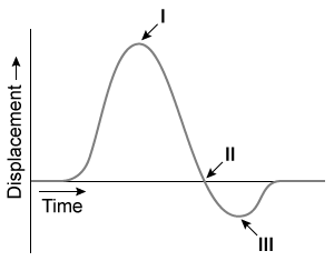 Laser Doppler vibrometers detect the Doppler shift of a laser beam reflected off an individual's chest to measure respiratory rate.  The calculated displacement of the chest during a breath using a 500-nm laser is shown below.   If the laser source is stationary, at which point(s)  would the observed frequency of the reflected laser be 6 × 10<sup>14</sup> Hz? A) II only B) I and II only C) I and III only D) II and III only