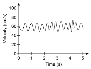Passage The flow of blood through the human body is typically laminar, but in certain conditions, as when blood flows through the aorta during a period of heightened physical activity, the flow can become turbulent. Blood flow can also become turbulent in abnormal cases in which the passage of blood is obstructed by constrictions within the blood vessel. The energy generated by blood turbulence creates sound vibrations that can be heard with a stethoscope.Using the technique of laser Doppler velocimetry, researchers recorded the blood velocity v at a point in the aorta of an experimental subject at different times during aerobic exercise. Table 1 shows the blood velocities observed over a 400 ms time interval.<strong>Table 1</strong> Blood Velocity within the Aorta of an Experimental Subject (mean velocity v̅ = 101 cm/s) Turbulent kinetic energy (TKE) is the kinetic energy per unit mass associated with turbulence within flowing fluids and is defined as: <strong>Equation 1</strong>where σ<sub>v</sub> is the standard deviation of the fluctuating fluid velocities at a point within the turbulent flow.Reynolds number Re is the quantity that ultimately measures whether a flow is turbulent or laminar. Re is defined in terms of the fluid density ρ, mean velocity of the flow v̅, conduit diameter d, and dynamic viscosity η of the fluid, as given by: <strong>Equation 2</strong>In the context of blood flow, d is the diameter of the blood vessel, and blood has a fluid density of about 1,060 kg∙m<sup>−3</sup> with a dynamic viscosity of about 0.003 kg∙m<sup>−1</sup>∙s<sup>−1</sup>. -Which graph depicts the flow with the largest turbulent kinetic energy? A) B) C) D)