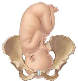 The nurse is admitting a pregnant client who is experiencing intense back labor. The nurse suspects the fetus is in which position? A) B) C) D)