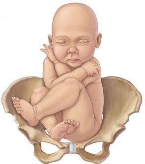 The nurse is admitting a pregnant client who is experiencing intense back labor. The nurse suspects the fetus is in which position? A) B) C) D)