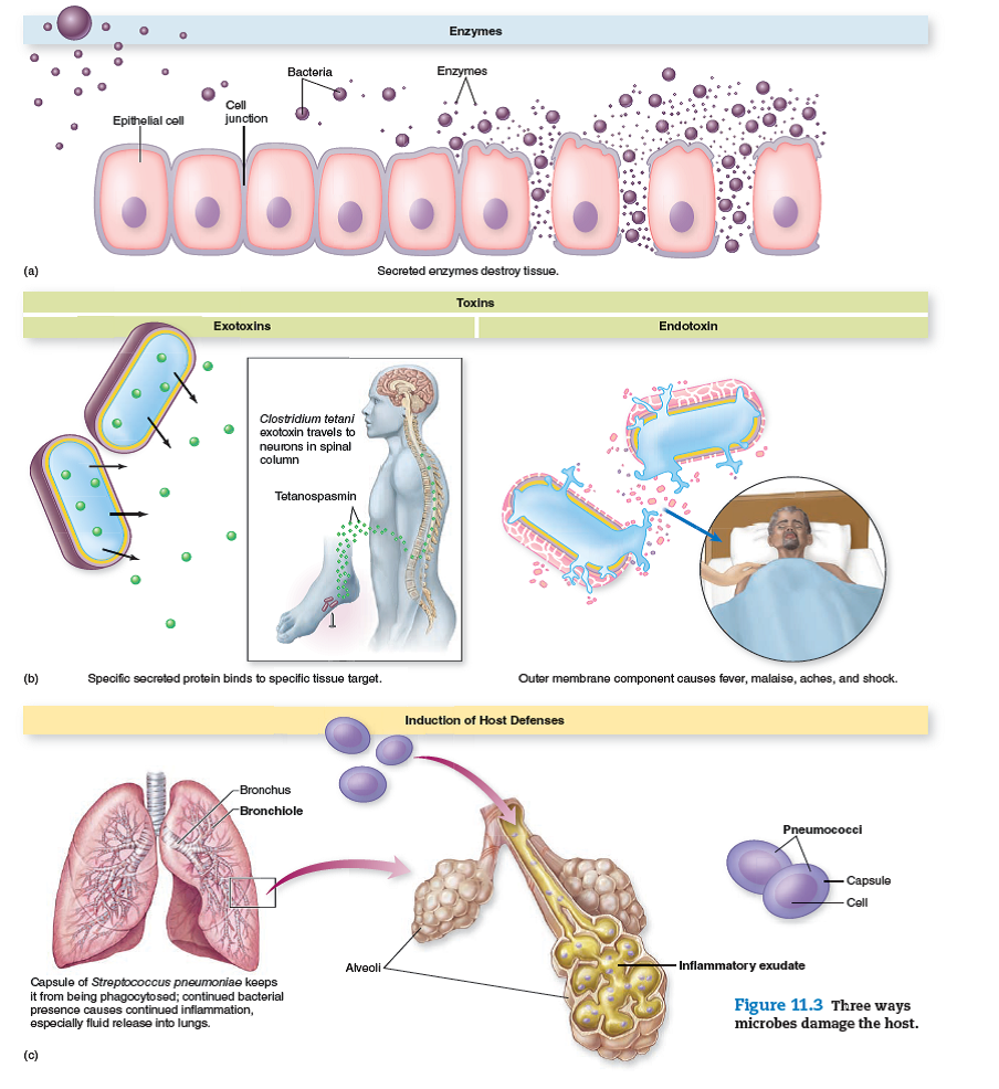 This question connects previous images to a new concept. From chapter 11, figure 11.3. Relate specific events in inflammation to the symptoms of pneumonia pictured in this drawing. Reference: chapter 11, figure 11.3