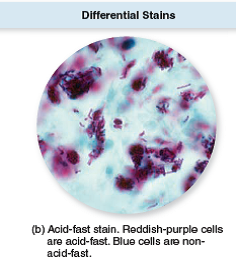 This question connects previous images to a new concept.  From chapter 2, figure 2.18 b. Although there are many different organisms present in the respiratory tract, an acid-fast stain of sputum like the one shown here along with patient symptoms can establish a presumptive diagnosis of tuberculosis. Explain why. Reference: chapter 2, figure 2.18 b    
