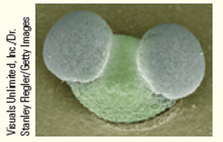 Pine trees are wind-pollinated plants. The distance that a pollen grain travels is determined by three factors that are observed in nature: (1) the height at which it is released, (2) the air flow or wind currents that it catches, and (3) how long the pollen grain can stay aloft. A pine pollen grain has two winglike projections that contain gas ( Fig. ). Which of the three factors is maximized by this structure? Figure Pine pollen grain.    