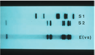 ANALYZING DATA. RFLP analysis was performed on blood from a crime scene as well as from two suspects. The crime scene DNA is marked E(vs). Which suspect is probably guilty Which suspect is definitely innocent