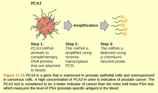 Figure 17.15 IN<sub>2</sub>011, the United States Preventative Services Task Force recommended against using the PSA test to screen healthy men for prostate cancer. Their recommendation is based on evidence that screening does not reduce the risk of death from prostate cancer. Prostate cancer often develops very slowly and does not cause problems, while the cancer treatment can have severe side effects. The PCA3 test is considered to be more accurate, but screening may still result in men who would not have been harmed by the cancer itself suffering side effects from treatment. What do you think? Should all healthy men be screened for prostate cancer using the PCA3 or PSA test? Should people in general be screened to find out if they have a genetic risk for cancer or other diseases?  