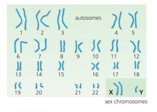 What condition is indicated by the following karyotype?  