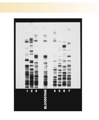You are a crime scene investigator testifying at a murder trial. The DNA fingerprints shown on the right are those of a blood- stain at the murder scene (not the victim's blood) and those of seven suspects (numbered 1 through 7). Which suspect's blood matches the bloodstain from the crime scene?