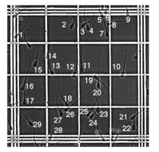 A bacterial culture is initially composed of 100 cells. After 1 hour, the number of bacteria is 1.5 times the initial population. a. If the rate of growth is proportional to the number of bacteria present, determine the time necessary for the number of bacteria to triple. A. b.     Figure 5.23 A. Side view of hemocytometer. B. View through microscope objective. Each ruled square is 0.25 mm on a side (i.e., the distance between the three thick lines is 1 mm). Photo courtesy of Dr. John Parrish.  b. What is the time required for a culture with 1 × 106 of the same bacteria to triple? Explain your results. c. Under what conditions would the answers obtained in b be invalid?