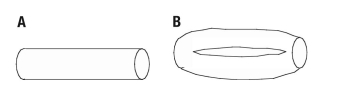 Examine one of the consequences of branching with a simple model shown in the ﬁgure. Assume that there are two blood-ﬂow circuits, which are identical except that one of the circuits has a single vessel, whereas the other has two identical vessels in parallel. a. If the resistance of a single vessel is R, what is the overall resistance of the two vessels in parallel? b. If each of the circuits carries the same ﬂow rate, which has the larger pressure drop? How do the two pressure drops compare?  