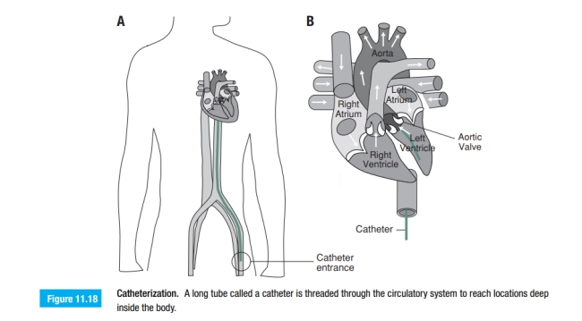 Figure 11.8 shows the relationship between resistance and temperature for the thermistor. a. From the curve provided in the ﬁgure, ﬁnd the coefﬁcient β. b. Show that the variation in resistance in the temperature range 35-39◦C can be approximated by a linear expression.  