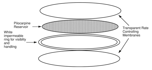 A schematic diagram of the Ocusert?R system for delivery of pilocarpine  is shown in the accompanying ﬁgure. Using your knowledge of diffusion  through polymer membranes (from Chapter 2), derive an equation that will  predict the rate of drug release (M, mg/h) from the following parameters:  drug concentration in the reservoir (cp, mg/mL), thickness of the membranes  (cm), diffusion coefﬁcient of drug in the membrane (DA,cm2/s), and surface  area of the device (A,cm2).  