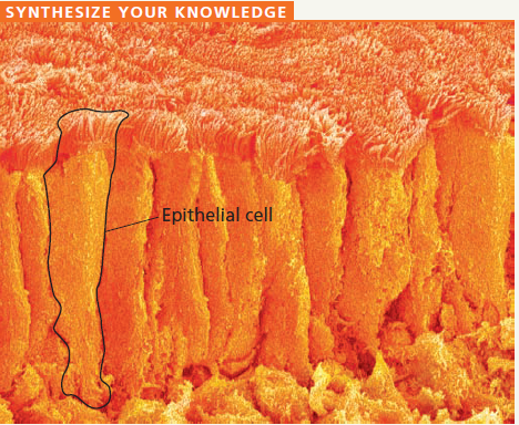    The cells in the SEM are epithelial cells from the small intestine. Discuss how aspects of their structure contribute to their specialized functions of nutrient absorption and as a barrier between the intestinal contents and the blood supply on the other side of the sheet of epithelial cells.