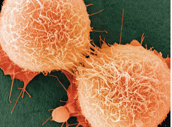    Shown here are two HeLa cancer cells that are just completing cytokinesis. Explain how the cell division of cancer cells like these is misregulated. What genetic and other changes might have caused these cells to escape normal cell cycle regulation