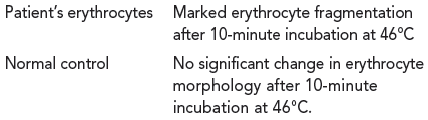 Interpret the results of the following thermal sensitivity test: