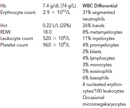 A 45-year-old Caucasian female was admitted to the hospital from the emergency room. She had experienced pain in the upper quadrant and bloating for the past several weeks. She had multiple bruises on her legs and arms. She also stated that her gums bled easily when she brushed her teeth. She had been unusually tired and lost about 10 lb in the last 2 months. Results of physical examination showed a massive spleen. The following laboratory results were noted on admission.   Anisocytosis and poikilocytosis were moderate. A bone marrow aspiration was performed. The marrow was 90% cellular with a myeloid-to-erythroid ratio of 10:1. The majority of the cells were neutrophilic precursors. Eosinophils and basophils were increased. Myeloblasts accounted for 10% of the nucleated cells. Megakaryocytes were increased. Which of the following terms most accurately describes this patient's peripheral blood picture? (Objectives 10, 13) A) leukemoid reaction B) leukoerythroblastic C) leukopenia D) myelodysplastic