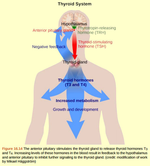 Figure 16.14 Goiter, a disease caused by iodine deficiency, results in the inability of the thyroid gland to form T3 and T4. The body typically attempts to compensate by producing greater amounts of TSH. Which of the following symptoms would you expect goiter to cause?  a. Hypothyroidism, resulting in weight gain, cold sensitivity, and reduced mental activity.  b. Hyperthyroidism, resulting in weight loss, profuse sweating and increased heart rate. c. Hyperthyroidism, resulting in weight gain, cold sensitivity, and reduced mental activity. d. Hypothyroidism, resulting in weight loss, profuse sweating and increased heart rate.  