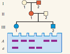 A human geneticist discovers the molecular variation in DNA sequence illustrated in the accompanying diagrams of electrophoresis gels. In the human population as a whole, she finds any of four phenotypes, shown in panel A. She believes that this may be a simple genetic polymorphism with three alleles, like the ABO blood groups. There are two alleles that yield DNA fragments of different sizes, fast (F) or slow (S) migration, and a null allele (O) in which the DNA fragment is deleted. The genotypes in panel A would therefore be, from left to right, FF or FO, SS or SO, FS, and OO. In the population as a whole, the putative OO genotype is extremely common, and the FS genotype is quite rare. To investigate this hypothesis further, the geneticist studies offspring of matings between parents who have the putative FS genotype (panel B). The types of progeny, and their numbers, are shown in panel C.  (a) What result would be expected from the three-allele hypothesis?  (b) Are the observed data consistent with this result? Why or why not?      (c) Suggest a genetic hypothesis that can explain the data in panel C. (d) Are the data consistent with your hypothesis?   