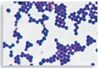 For the following figures a-e, research the chapter and book to find an appropriate drug to treat an infection with the microbe shown, and explain what its effects on the microbe will be.   (a) Figure 18.1   (b) Figure 6.8b   c) Figure 5.15c   (d) Figure 5.26c   (e) Figure 5.28<div style=padding-top: 35px> 