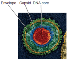 For the following figures a-e, research the chapter and book to find an appropriate drug to treat an infection with the microbe shown, and explain what its effects on the microbe will be.   (a) Figure 18.1   (b) Figure 6.8b   c) Figure 5.15c   (d) Figure 5.26c   (e) Figure 5.28<div style=padding-top: 35px> 
