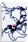 Each numbered figure 1-4 represents a cell that provides an immune defense. Each lettered figure A-D shows a pathogenic microbe. Name the type of defense and match it with its primary target microbe and effects.   (1) Figure 14.19   (2) Page 435   (3) Page 435   (4) Page 435   A Figure 18.8   B Figure 23.21 inset   C Table 25.1   D Opener, Chapter 14<div style=padding-top: 35px> 