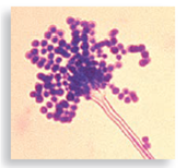 Each numbered figure 1-4 represents a cell that provides an immune defense. Each lettered figure A-D shows a pathogenic microbe. Name the type of defense and match it with its primary target microbe and effects.   (1) Figure 14.19   (2) Page 435   (3) Page 435   (4) Page 435   A Figure 18.8   B Figure 23.21 inset   C Table 25.1   D Opener, Chapter 14<div style=padding-top: 35px> 
