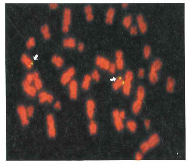 Suppose you performed a fluorescence in situ hybridization experiment (FISH) on chromosomes from a human cell using a probe corresponding to a gene located near (but not at) the telomere of the q arm of chromosome 4. a. On the following idiogram, which shows only chromosomes 1-5 contained in this diploid cell, indicate the location of all fluorescent signals.   b. Compare your idiogram with the result of the FISH experiment shown in Fig. 11.9a. Why are the chromosomes scattered in Fig. 11.9a, rather than being present in neatly arranged pairs of homologous chromosomes as in the idiogram Do you think it is likely that the gene whose DNA was used as a probe in Fig. 11.9a is found on the q arm of human chromosome 4 Figure 11.9 Fluorescent In situ hybridization. (a) FISH analysis of a human cell's chromosomes. The four yellow spots show where a probe made from a angle gene hybridizes to the two sister chromatids on each of two homologous chromosomes. (b) Spectral karyotyping (SKY). Probesmade from DNA along the length of each chromosome are labeled with fluorescent tags of different colors. (a)   (b)  <div style=padding-top: 35px> 