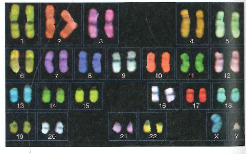 Suppose you performed a fluorescence in situ hybridization experiment (FISH) on chromosomes from a human cell using a probe corresponding to a gene located near (but not at) the telomere of the q arm of chromosome 4. a. On the following idiogram, which shows only chromosomes 1-5 contained in this diploid cell, indicate the location of all fluorescent signals.   b. Compare your idiogram with the result of the FISH experiment shown in Fig. 11.9a. Why are the chromosomes scattered in Fig. 11.9a, rather than being present in neatly arranged pairs of homologous chromosomes as in the idiogram Do you think it is likely that the gene whose DNA was used as a probe in Fig. 11.9a is found on the q arm of human chromosome 4 Figure 11.9 Fluorescent In situ hybridization. (a) FISH analysis of a human cell's chromosomes. The four yellow spots show where a probe made from a angle gene hybridizes to the two sister chromatids on each of two homologous chromosomes. (b) Spectral karyotyping (SKY). Probesmade from DNA along the length of each chromosome are labeled with fluorescent tags of different colors. (a)   (b)  <div style=padding-top: 35px> 