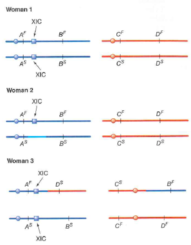 On the following figures, genes A and B are on the X chromosome ( blue ) and both are subject to X inactivation, while genes C and D are on chromosome 17 (an autosome; red ). F and S refer to alleles encoding fast-and slow-migrating forms of the corresponding proteins that can be discriminated by electrophoresis. For women 2 and 3 in the figures that follow, indicate all the possible forms of the four proteins that could be expressed in clones made from different individual somatic cells that already had one or more Barr bodies. As an example, some clones from normal woman 1 could express the A F , B F , C F , C S , D F , and D S proteins, while other clones could express the A S , B S , C F , C s , D F and D S proteins. None of the clones from woman 1 should make both the slow and fast forms of proteins A or B. Woman 2 is a heterozygote for a deletion of the XIC. Woman 3 is a heterozygote for a reciprocal translocation in which parts of the X chromosome and chromosome 17 have exchanged places.  <div style=padding-top: 35px> 