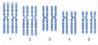 a. In a fluorescent in situ hybridization (FISH) experiment, what would you see if you used DNA containing multiple copies of 3 ' AATCCC 5 ' as a probe Show your results on the idiogram accompanying Problem 9 on p. 404. b. What DNA sequence would you use as a probe to track one end of one particular chromosome in a FISH experiment What would your results look like on the same idiogram Problem 9 Suppose you performed a fluorescence in situ hybridization experiment (FISH) on chromosomes from a human cell using a probe corresponding to a gene located near (but not at) the telomere of the q arm of chromosome 4. a. On the following idiogram, which shows only chromosomes 1-5 contained in this diploid cell, indicate the location of all fluorescent signals.   b. Compare your idiogram with the result of the FISH experiment shown in Fig. 11.9a. Why are the chromosomes scattered in Fig. 11.9a, rather than being present in neatly arranged pairs of homologous chromosomes as in the idiogram Do you think it is likely that the gene whose DNA was used as a probe in Fig. 11.9a is found on the q arm of human chromosome 4 Figure 11.9 Fluorescent In situ hybridization. (a) FISH analysis of a human cell's chromosomes. The four yellow spots show where a probe made from a angle gene hybridizes to the two sister chromatids on each of two homologous chromosomes. (b) Spectral karyotyping (SKY). Probesmade from DNA along the length of each chromosome are labeled with fluorescent tags of different colors. (a)   (b)  <div style=padding-top: 35px> 