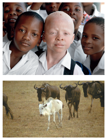 Figure 24.1 illustrates albinism in two different species. Describe two other genetic disorders found in both humans and animals. FIGURE 24.1 The albino phenotype in a human and a wildebeest.