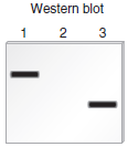 Chapter 20 describes a blotting method known as Western blotting that can be used to detect the production of a polypeptide that is translated from a particular mRNA. In this method, a protein is detected with an antibody that specifically recognizes and binds to its amino acid sequence. The antibody acts as a probe to detect the presence of the protein. In a Western blotting experiment, a mixture of cellular proteins is separated using gel electrophoresis according to their molecular masses. After the antibody has bound to the protein of interest within a blot of a gel, the protein is visualized as a dark band. For example, an antibody that recognizes the -globin polypeptide could be used to specifically detect the -globin polypeptide in a blot. As shown here, the method of Western blotting can be used to determine the amount and relative size of a particular protein that is produced in a given cell type.    a. Lane 1 is a sample of proteins isolated from normal red blood cells.Lane 2 is a sample of proteins isolated from kidney cells. Kidney cells do not produce globin.Lane 3 is a sample of proteins isolated from red blood cells from a patient with -thalassemia. This patient is homozygous for a mutation that results in the shortening of the -globin polypeptide.Now here is the question. A protein called troponin contains 334 amino acids. Because each amino acid weighs 120 daltons (Da) (on average), the molecular mass of this protein is about 40,000 Da, or 40 kDa. Troponin functions in muscle cells, and it is not expressed in nerve cells. Draw the expected results of a Western blot for the following samples: Lane 1: Proteins isolated from muscle cells Lane 2: Proteins isolated from nerve cells Lane 3: Proteins isolated from the muscle cells of an individual who is homozygous for a mutation that introduces a stop codon at codon 177