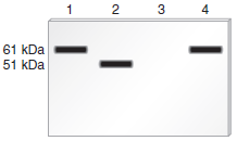 The protein known as tyrosinase is needed to make certain types of pigments. Tyrosinase is composed of a single polypeptide with 511 amino acids. Because each amino acid weighs 120 Da (on average), the molecular mass of this protein is approximately 61,300 Da, or 61.3 kDa. People who carry two defective copies of the tyrosinase gene have the condition known as albinism. They are unable to make pigment in the skin, eyes, and hair. Western blotting can be used to detect proteins that are translated from a particular mRNA. This method is described in Chapter 20 and also in experimental question E5. Skin samples were collected from a pigmented individual (lane 1) and from three unrelated albino individuals (lanes 2, 3, and 4) and subjected to a Western blot analysis using an antibody that recognizes tyrosinase. Explain the possible cause of albinism in the three albino individuals.    a. Question E5  Chapter 20 describes a blotting method known as Western blotting that can be used to detect the production of a polypeptide that is translated from a particular mRNA. In this method, a protein is detected with an antibody that specifically recognizes and binds to its amino acid sequence. The antibody acts as a probe to detect the presence of the protein. In a Western blotting experiment, a mixture of cellular proteins is separated using gel electrophoresis according to their molecular masses. After the antibody has bound to the protein of interest within a blot of a gel, the protein is visualized as a dark band. For example, an antibody that recognizes the -globin polypeptide could be used to specifically detect the -globin polypeptide in a blot. As shown here, the method of Western blotting can be used to determine the amount and relative size of a particular protein that is produced in a given cell type.    a. Lane 1 is a sample of proteins isolated from normal red blood cells.Lane 2 is a sample of proteins isolated from kidney cells. Kidney cells do not produce globin.Lane 3 is a sample of proteins isolated from red blood cells from a patient with -thalassemia. This patient is homozygous for a mutation that results in the shortening of the -globin polypeptide.Now here is the question. A protein called troponin contains 334 amino acids. Because each amino acid weighs 120 daltons (Da) (on average), the molecular mass of this protein is about 40,000 Da, or 40 kDa. Troponin functions in muscle cells, and it is not expressed in nerve cells. Draw the expected results of a Western blot for the following samples: Lane 1: Proteins isolated from muscle cells Lane 2: Proteins isolated from nerve cells Lane 3: Proteins isolated from the muscle cells of an individual who is homozygous for a mutation that introduces a stop codon at codon 177