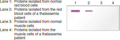 In the Western blot shown here, proteins were isolated from red blood cells and muscle cells from two different individuals. One individual was unaffected, and the other individual suffered from a disease known as thalassemia, which involves a defect in hemoglobin. In the Western blot, the gel blot was exposed to an antibody that recognizes globin, which is one of the polypeptides that constitute hemoglobin. Equal amounts of total cellular proteins were added to each lane.    a. Explain these results.