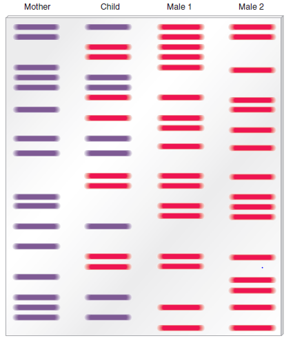 Here are traditional DNA fingerprints of five people: a child, mother, and three potential fathers: a. Which males can be ruled out as being the father Explain your answer. If one of the males could be the father, explain the general strategy for calculating the likelihood that he could match the offspring's DNA fingerprint by chance alone. (See solved problem S6 before answering this question.) Problem S6 An important application of DNA fingerprinting is relationship testing. Persons who are related genetically have some bands or peaks in common. The number they share depends on the closeness of their genetic relationship. For example, an offspring is expected to receive half of his or her minisatellites from one parent and the rest from the other. The diagram shown here schematically illustrates a traditional DNA fingerprint of an offspring, mother, and two potential fathers. a. In paternity testing, the offspring's DNA fingerprint is first compared with that of the mother. The bands that the offspring have in common with the mother are depicted in purple. The bands that are not similar between the offspring and the mother must have been inherited from the father. These bands are depicted in red. Which male could be the father