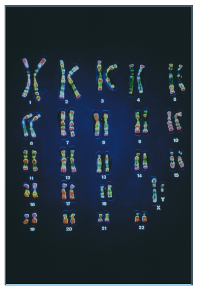 Figure 1.5 shows a micrograph of chromosomes from a normal human cell. If you performed this type of experiment using cells from a person with Down syndrome, what would you expect to see FIGURE 1.5 A micrograph of the 46 chromosomes found in a cell from a human male.  <div style=padding-top: 35px> 