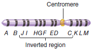 An inversion heterozygote has the following inverted chromosome: What would be the products if a crossover occurred between genes H and I on one inverted and one normal chromosome