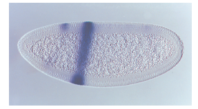 You need to understand solved problem S4 before answering this question. If the artificial gene containing the stripe 2 enhancer and the -galactosidase gene was found within an embryo that also contained the following loss-of-function mutations, what results would you expect In other words, would there be a stripe or not Explain why. A. Krüppel  B. bicoid  C. hunchback  D. giant  Solved Problem S4  An intriguing question in developmental genetics is, how can a particular gene, such as even-skipped, be expressed in a multiple banding pattern as seen in Figure 25.11 Another way of asking this question is, how is the positional information within the broad bands of the gap genes able to be deciphered in a way that causes the pair-rule genes to be expressed in this alternating banding pattern The answer lies in a complex mechanism of genetic regulation. Certain pair-rule genes have several stripe-specific enhancers that are controlled by multiple transcription factors. A stripe-specific enhancer is typically a short segment of DNA, 300-500 bp in length, that contains binding sequences recognized by several different transcription factors. This term is a bit misleading because a stripe-specific enhancer is a regulatory region that contains both enhancer and silencer elements. In 1992, Michael Levine and his colleagues investigated stripe-specific enhancers located near the promoter of the even-skipped gene. A segment of DNA, termed the stripe 2 enhancer, controls the expression of the even-skipped gene; this enhancer is responsible for the expression of the even-skipped gene in stripe 2, which corresponds to parasegment 3 of the embryo. The stripe 2 enhancer is a segment of DNA that contains binding sites for four transcription factors that are the products of the Krüppel, bicoid, hunchback, and giant genes. The Hunchback and Bicoid transcription factors bind to this enhancer and activate the transcription of the even-skipped gene. In contrast, the transcription factors encoded by the Krüppel and giant genes bind to the stripe 2 enhancer and repress transcription. The figure shown next describes the concentrations of these four transcription factor proteins in the region of parasegment 3 (i.e., stripe 2) in the Drosophila embryo.    To study stripe-specific enhancers, researchers have constructed artificial genes in which the enhancer is linked to a reporter gene, the expression of which is easy to detect. The next figure shows the results of an experiment in which an artificial gene was made by putting the stripe 2 enhancer next to the -galactosidase gene. This artificial gene was introduced into Drosophila, and then embryos containing this gene were analyzed for -galactosidase activity. If a region of the embryo is expressing -galactosidase, the region will stain darkly because -galactosidase converts a colorless compound into a dark blue compound.    Explain these results. FIGURE 25.11 Overview of the genetic hierarchy leading to segmentation in Drosophila. Note: When comparing steps 3 and 4, the elongated embryo bends in the middle and folds back on itself.  