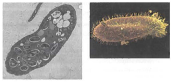 Making Comparisons Look at the photographs below. The TEM (left) is a photo of a paramecium. The SEM (right) is also a photo of a paramecium. Compare and contrast what each electron micrograph reveals to you about this organism.   