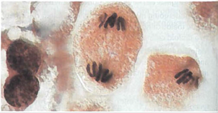 Interpreting Graphics The photograph below shows cell division In plant. The offspring cells will divide a second time. Do you think the photograph shows mitosis or meiosis? Explain your answer.   